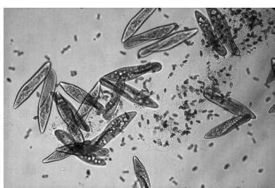  Heterotrichia: Deze unieke Ciliate met haren is een waar meester van camouflage en zwemkunst!